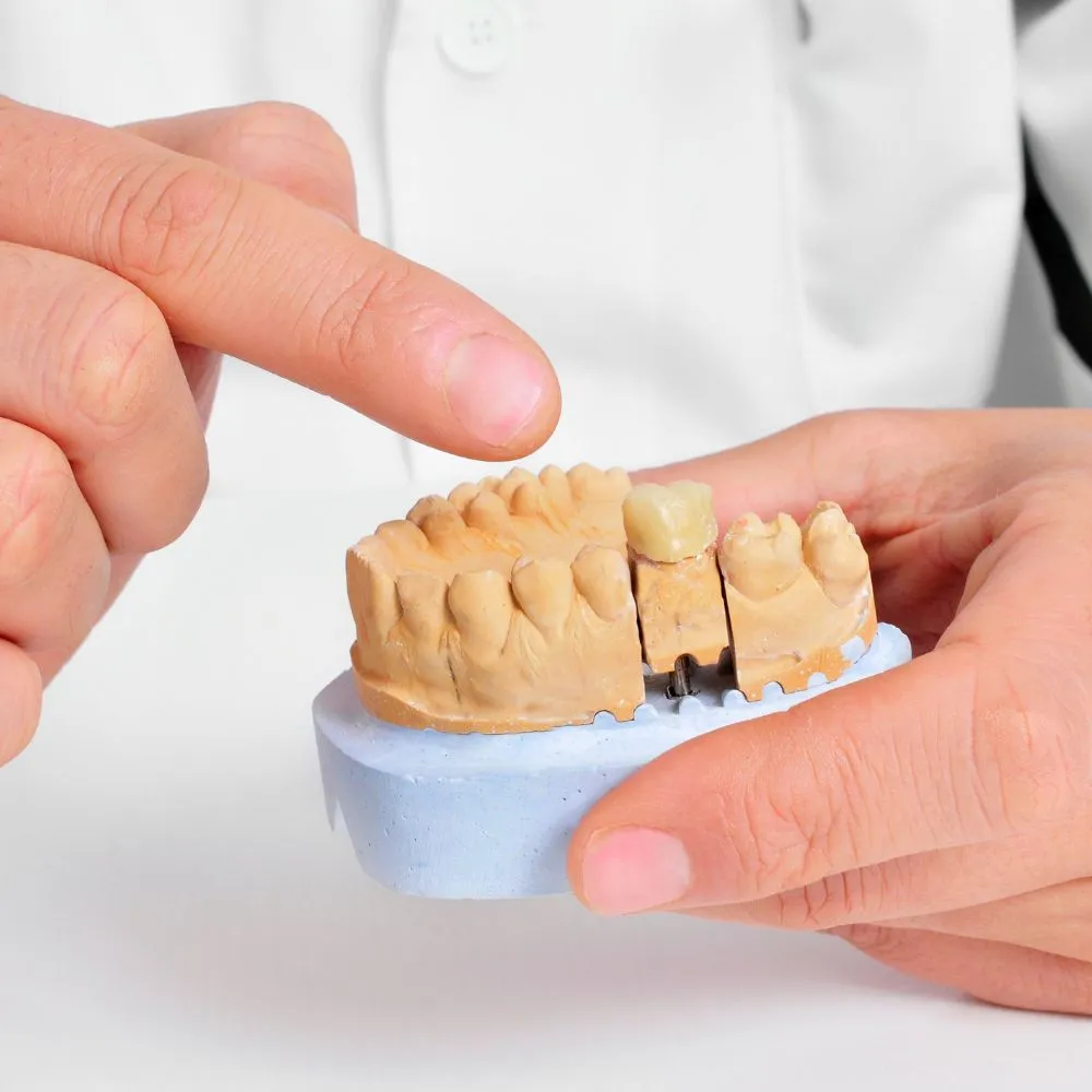 dentista protesi fisse e mobili a catania