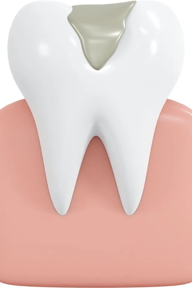 salva i tuoi denti naturali