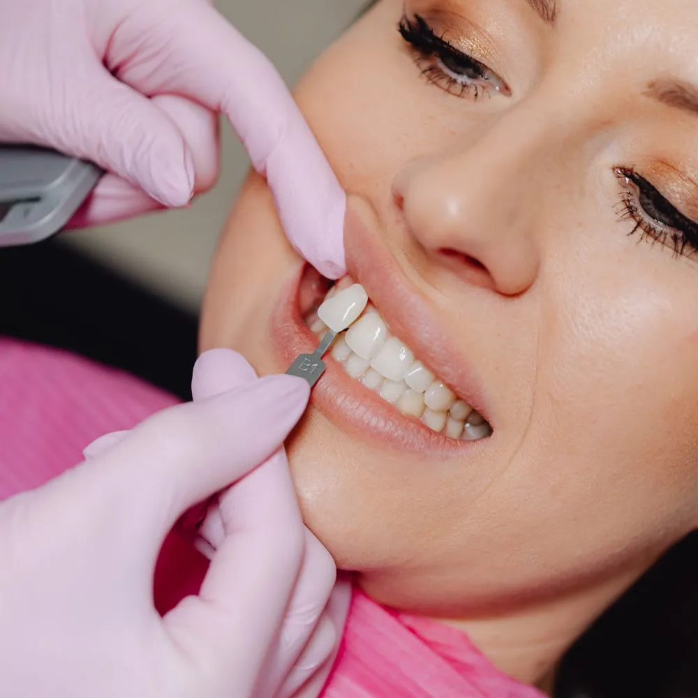 FACCETTE DENTALI A CATANIA